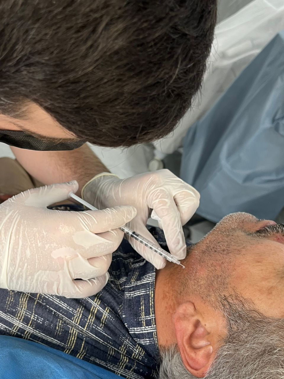 درمان ریزش موی سکه ای